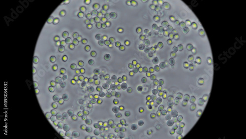 Yeast under the microscope, used for baking bread.