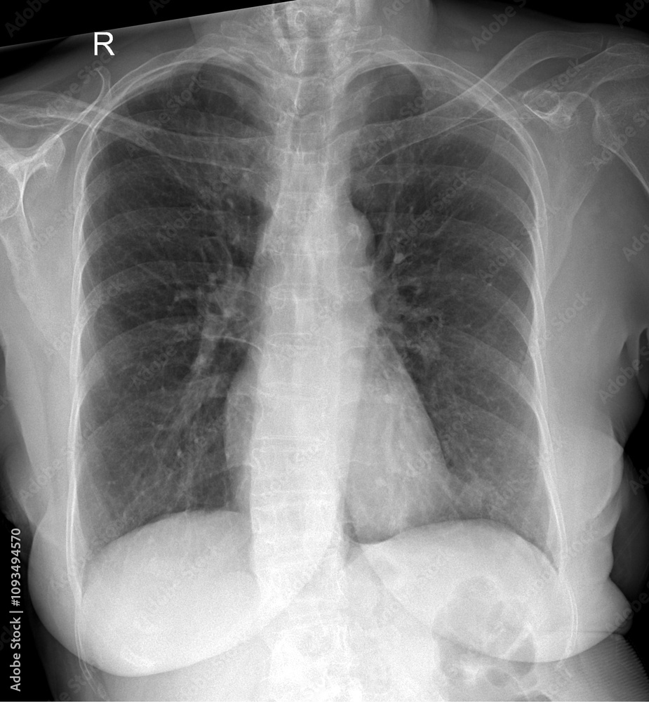 Detailed X-Ray of Human Ribcage and Chest for Medical Use Detailed X-Ray of Human Ribcage and Chest for Medical Use