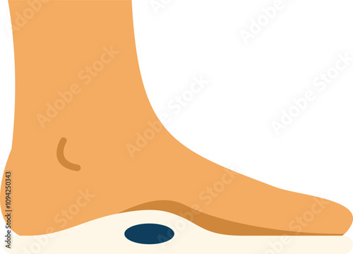 Human foot standing on orthopedic insole with arch support, providing comfort and correcting flatfoot issues