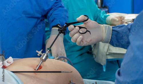 Surgeon doing endoscopic surgery