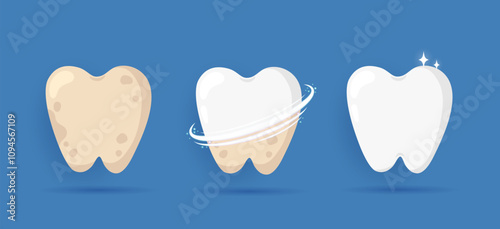 Cleaning and whitening teeth concept. Cartoon white tooth and tooth with yellow plaque before and after cleaning. Process of tooth whitening and repair. Dental care and oral hygiene design