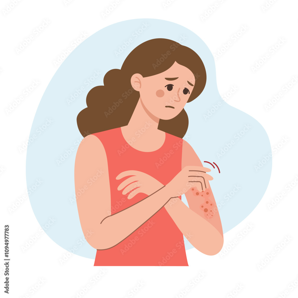 Woman scratches her hand. Allergic itching, skin inflammation, redness and irritation. Atopic dermatitis, eczema, psoriasis. Healthcare and medicine. Woman scratches her hand. Allergic itching, skin inflammation, redness and irritation. Atopic dermatitis, eczema, psoriasis. Healthcare and medicine.