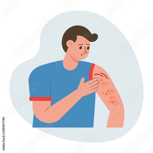 Man scratching his hand. Allergic itching, skin inflammation, redness and irritation. Atopic dermatitis, eczema, psoriasis. Healthcare and medicine.