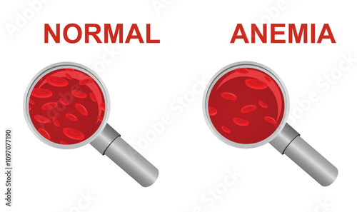 Normal and anemia icon. vector