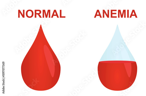 Normal and anemia icon. vector