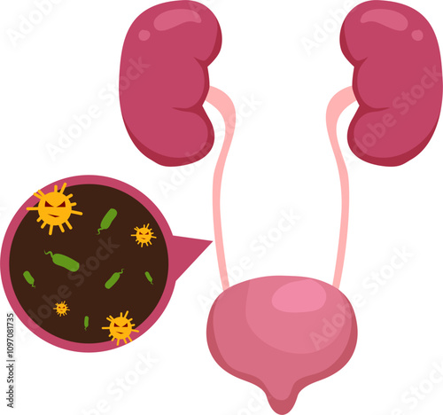 Bladder disease illustration. Urinary tract infection. Bladder cancer. Bladder stones. Bladder inconvenience.