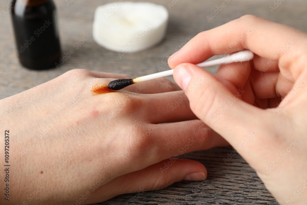 Woman applying topical iodine with cotton swab on hand at wooden table, closeup Woman applying topical iodine with cotton swab on hand at wooden table, closeup