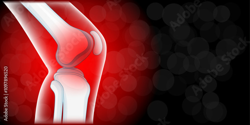 Knee joint pain.