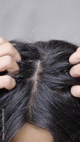 Close up of a girl strongly scratches her head with her hands. black hair with dandruff.