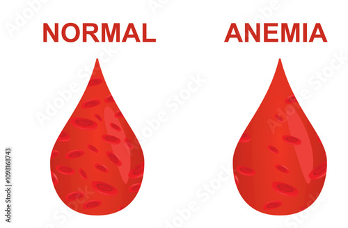 Normal and anemia icon. vector