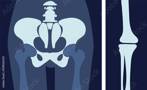 X rays image with bone. Xray of pelvis and knee. Diagnosis and treatment. Healthcare and medicine. Human anatomy and biology. Flat vector illustration