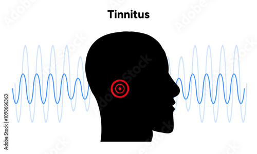 Tinnitus noise in human ear buzzing and dizziness disease 
