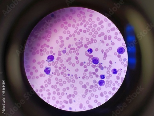 Human blood cells as seen under a microscope photo