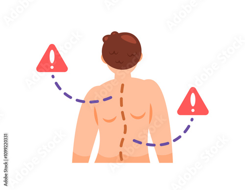 illustration of a man with scoliosis. spinal deformity, curved spine. posture. problems and health. flat style character design. elements