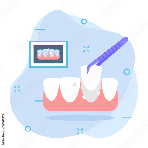 cosmetic teeth Veneers  treatment concept, Tooth crown or cap bridge Hybrid Designed Dental Bridge vector color icon design, Dentistry symbol, Healthcare sign, Dental instrument stock illustration