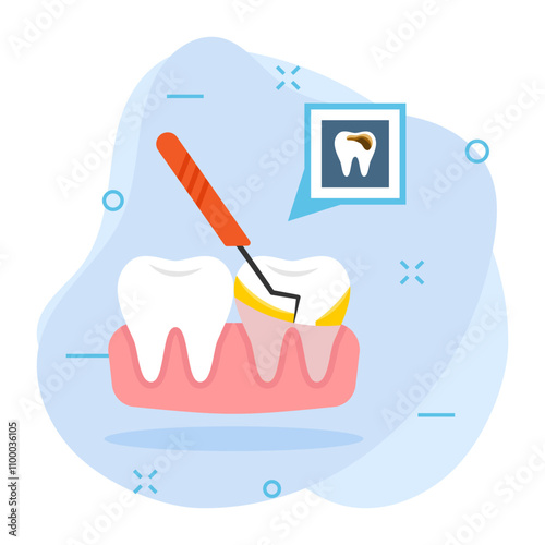 Cavities or tooth decay concept,  Removing calculus tartar vector color icon design, Dentistry symbol, Healthcare sign, Dental instrument stock, rough and hardened surface formed on teeth illustration