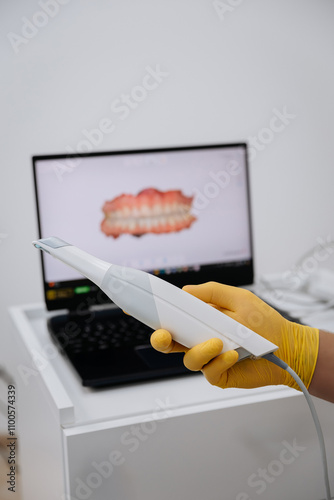 Dentist holding a 3D intraoral scanner with a digital teeth model on a laptop in the background