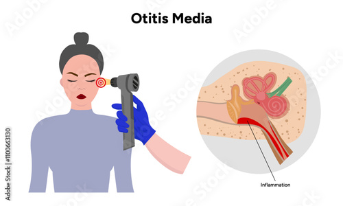 Otitis media inflammation anatomy human ear pain disease medical infographic and check up in doctor appointment 
