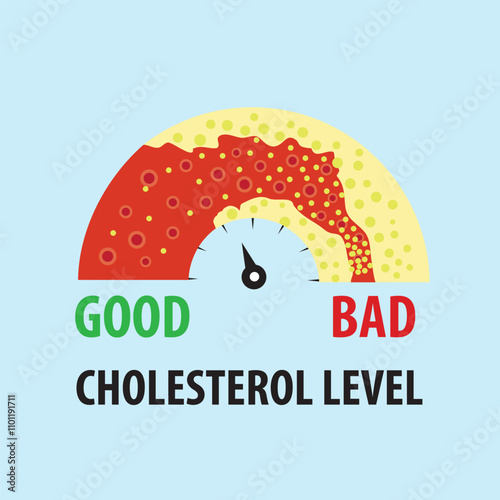 Cholesterol level on blocked blood vessel medical diagram. Meter gauge of bad hdl lipoprotein. High and low fat test indicator. Atherosclerosis risk. Healthcare concept. Vector illustration.