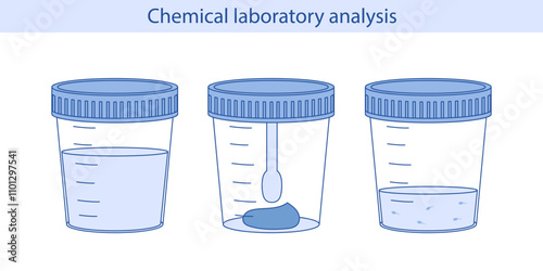 Medical analysis, laboratory analysis of urine, stool, sperm in plastic jars. Chemical laboratory analysis. Vector illustration in flat style