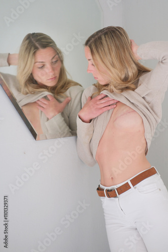 strong brave woman looks into mirror, gently lifting her shirt to reveal the early stages of breast reconstruction after mastectomy due to breast cancer, moment of reflection and healing