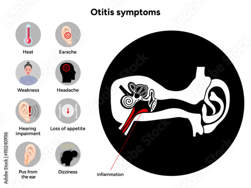 Otitis media and externa symptoms Ear human disease