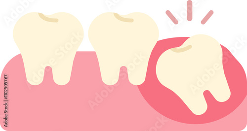 wisdom tooth removal remove discomfort pain oral dental care health