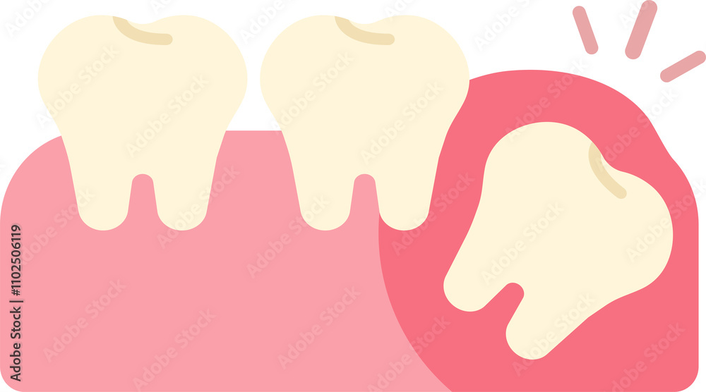 wisdom tooth removal remove discomfort pain oral dental care health wisdom tooth removal remove discomfort pain oral dental care health