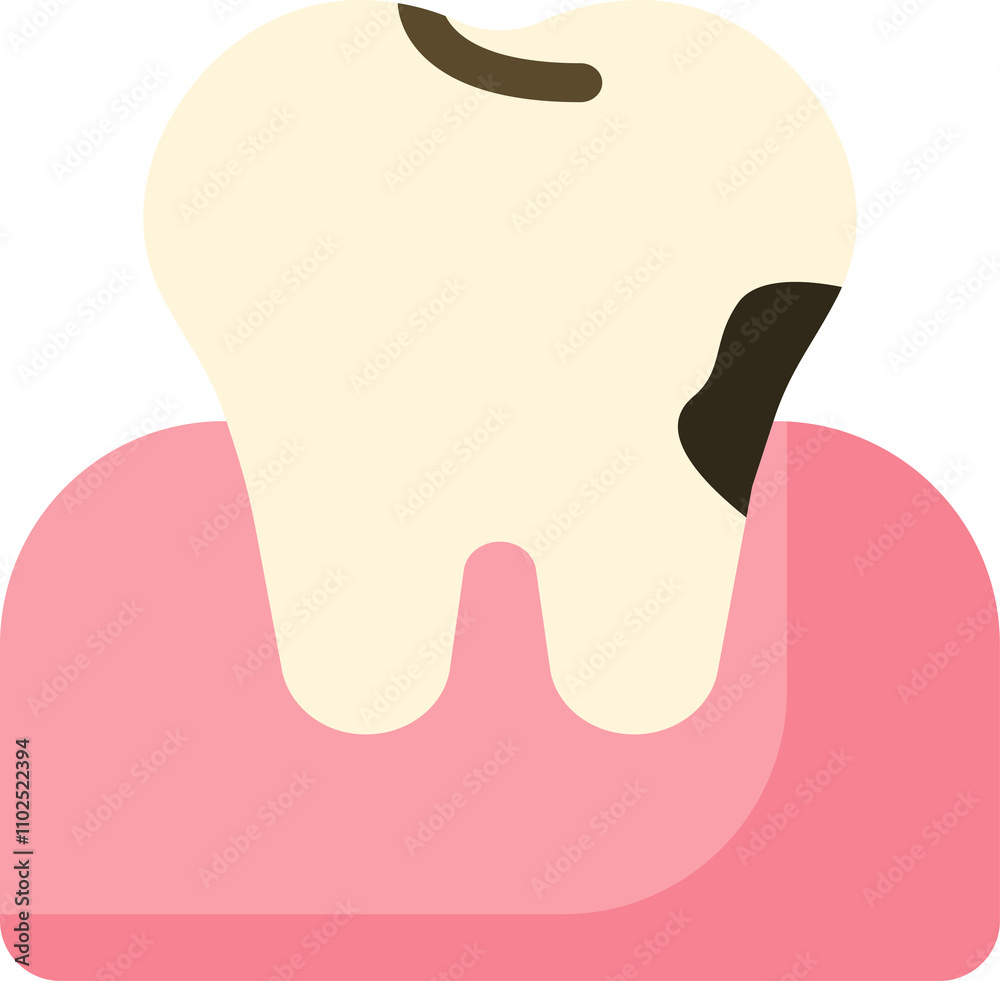 tooth cavity caries carious tooth cavity treatment root canal treatment tooth cavity caries carious tooth cavity treatment root canal treatment