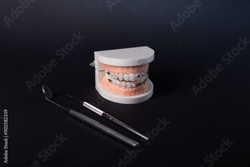 dental model with braces - Teeth orthodontic dental model with dental braces photo