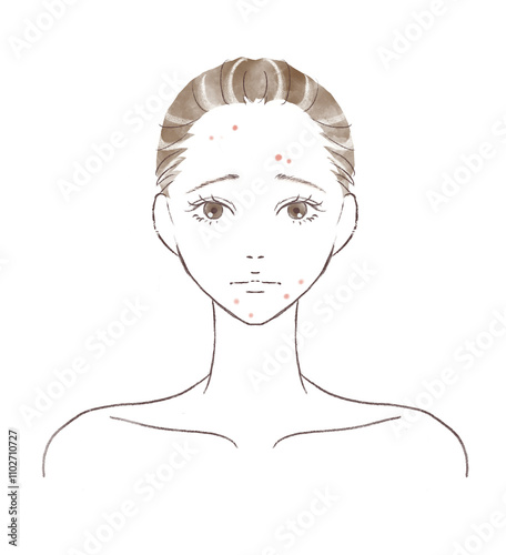 ニキビに悩み悲しんでいる水彩風女性