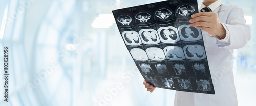Cuadro en lienzo radiology concept