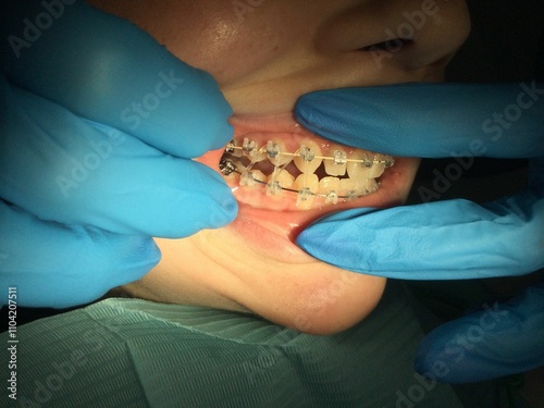 Dental treatment with braces in a clinic setting