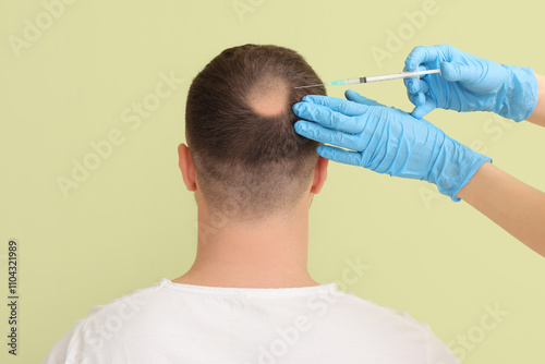 Young man with hair loss pr...