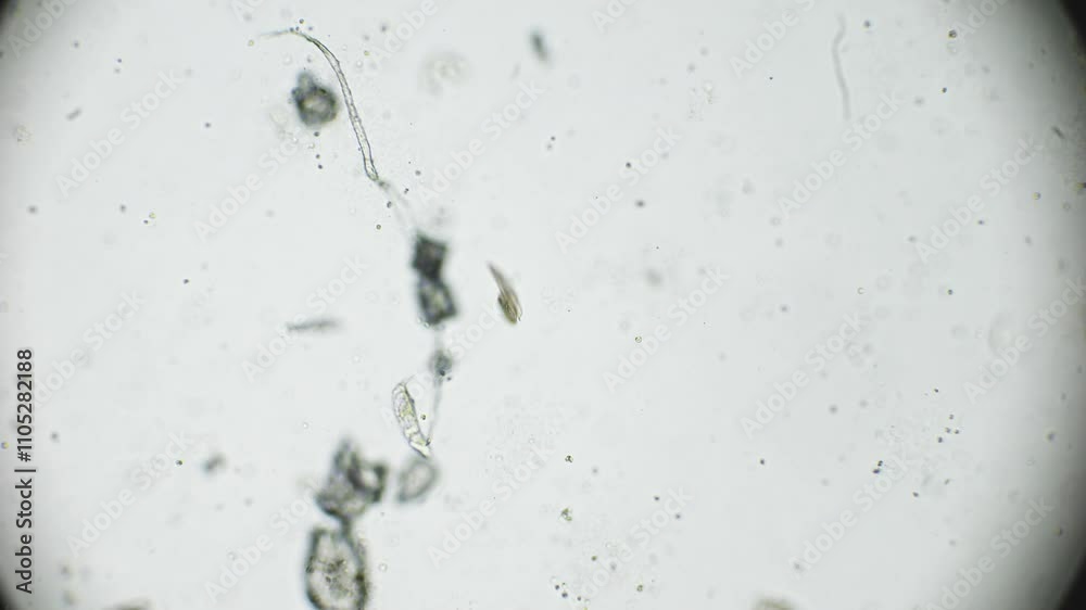 Rotifers captured under a microscope, revealing their internal ...