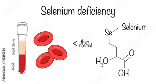 Selenium deficiency