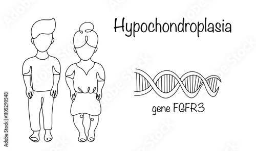Hypochondroplasia