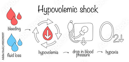 Hypovolemic shock