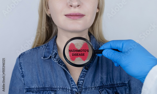 Thyroid disease - autoimmune thyroiditis, Hashimoto's disease. The doctor examines the patient's thyroid gland with a diagnosis written on it through a magnifying glass