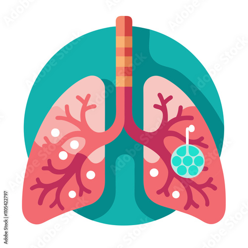  Lung cancer