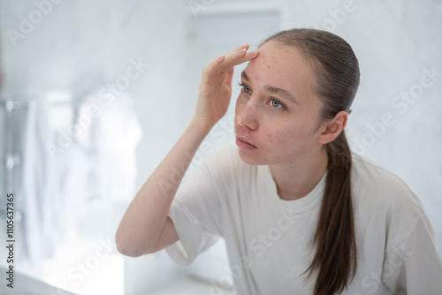 Gen z woman looking at her acne on forehead, stands before a mirror in bathroom touching her skin. Concept of acne treatment, skincare, adult acne