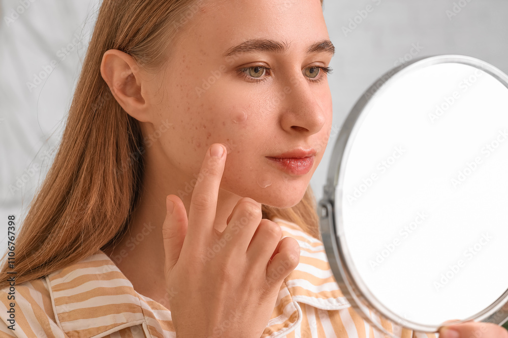 Young woman with acne problem and mirror applying pimple patches in bedroom, closeup Young woman with acne problem and mirror applying pimple patches in bedroom, closeup