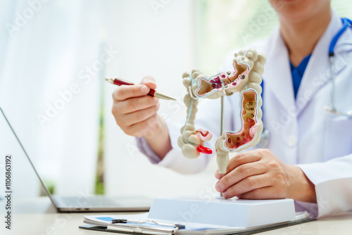 A male doctor wearing glasses sits at a desk, explaining an intestinal model, discussing anatomy, small and large intestine functions, colitis, colon cancer, appendicitis symptoms,digestive health photo