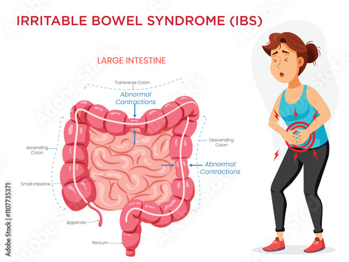 Irritable Bowel Syndrome Visualizing Symptoms with an Intestine Diagram