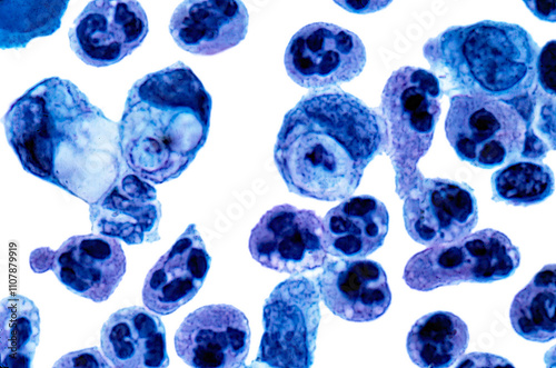 Macrophages and polymorphonuclear leukocytes