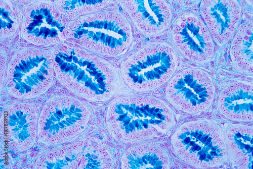 Mucous glandular epithelium photo