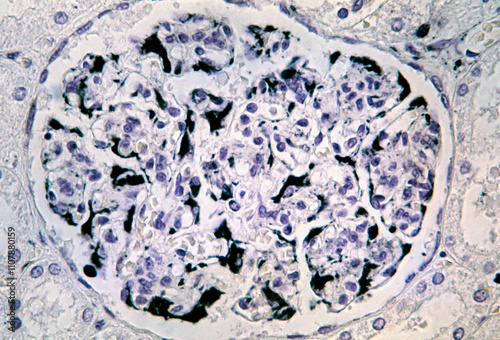 Kidney glomerulus. Podocytes. Vimentin photo