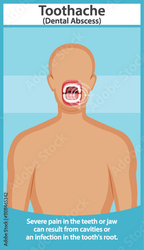 Understanding Toothache and Dental Abscess