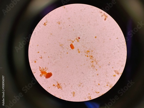 Blastocystis hominis  photo