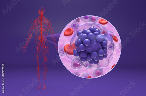 Diffuse large B-cell lymphoma (DLBCL) - isometric view 3d illustration